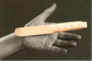 Finger Extension Splint-image